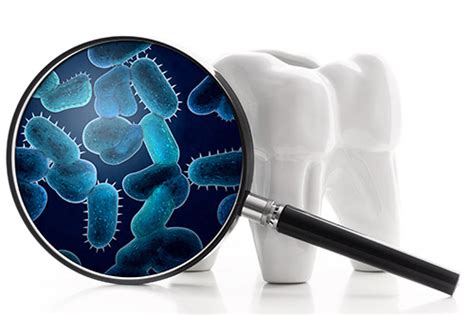 How Oral Bacteria Suppress Protection Against Viral Growth Erris Dental