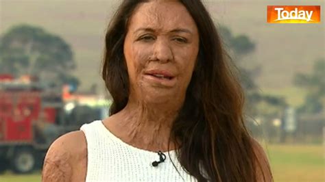 Australia Bushfires Turia Pitt Launches Campaign To Support Tourist Driven Towns Affected By Fires