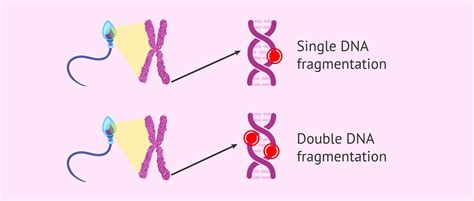 Sperm Fragmentation Single And Double Stranded