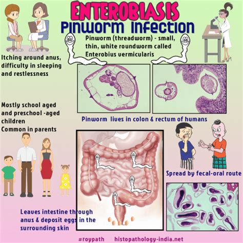 Pathology Of Enterobiasis Dr Sampurna Roy Md