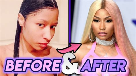 nicki minaj before and after transformations new nose plastic surgery transformation