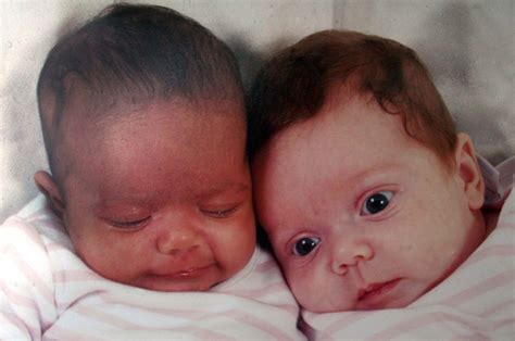 Meet The Black And White Twins That Baffle Everyone