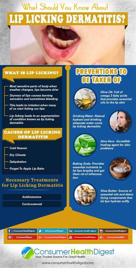 Pin By Tammy Poppell On Good To Know Lip Lickers Dermatitis