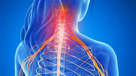 Neck Pain Causes And Effective Treatment Youtube