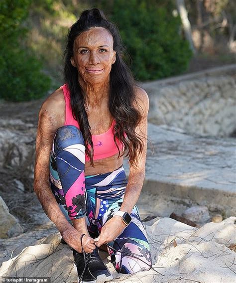Turia Pitt Reveals What Went Through Her Mind When She Was Being Burnt Alive In Outback Marathon