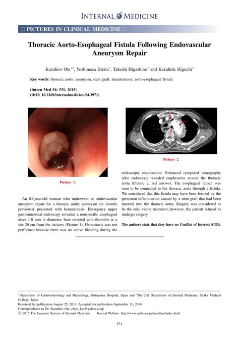 PDF Thoracic Aorto Esophageal Fistula Following Endovascular Aneurysm