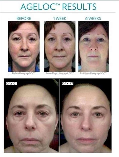 Galvanic Spa Before And After Use Sponsoring Distributor Id Id3014278 When You Sign Up As A