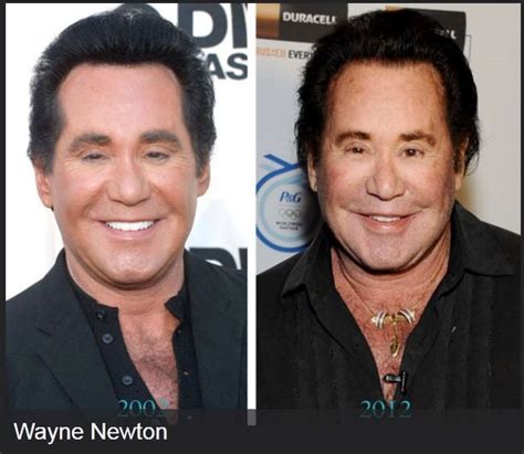 Celebrities Before And After Plastic Surgeries Celebrities