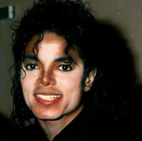 Wereld Vitiligodag Elf Jaar Na Het Overlijden Van Michael Jackson