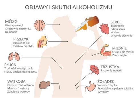Czym Jest Neuropatia Alkoholowa Poznaj Przyczyny Objawy I Leczenie
