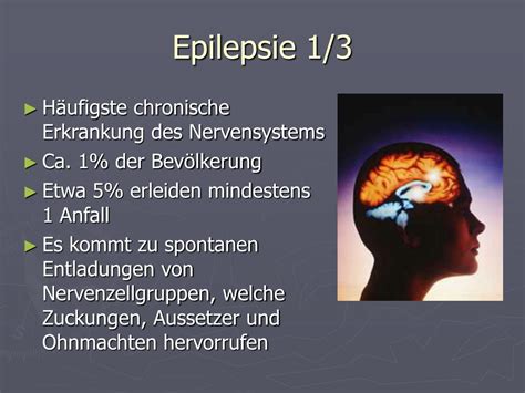 Epilepsie Ursachen Und Symptome Ndrde Ratgeber