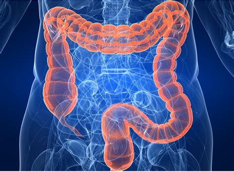 Colon Cancer Symptoms Stages Causes And Treatment Off