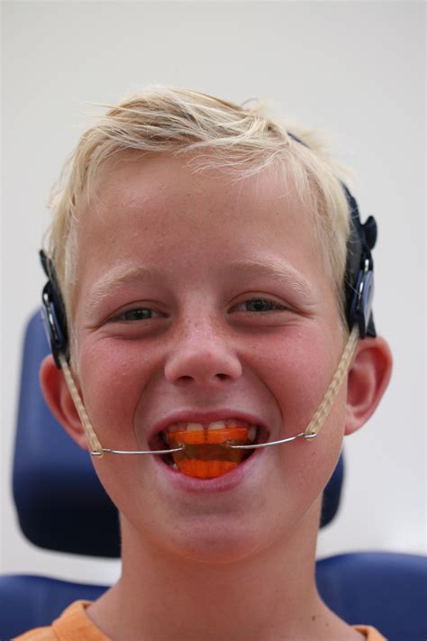 Orthodontiepraktijk Leeuwarden Vrolijke Jongen Met Van Beek Activator