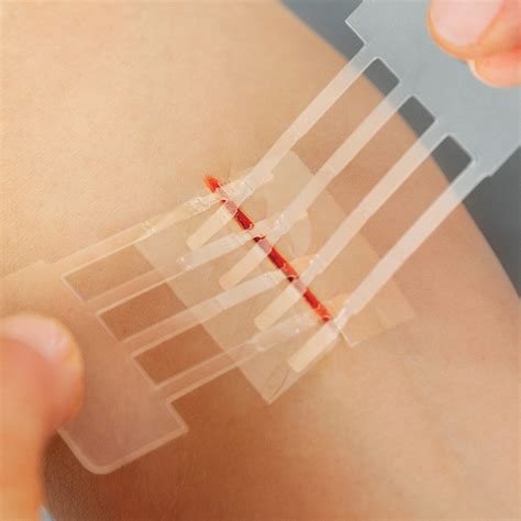 Clozex Emergency Laceration Closures Repair Wounds Without Stitches