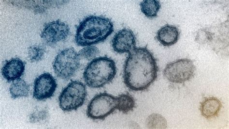 Coronavirus Las Imágenes Microscópicas Que Revelan Detalles Del Virus