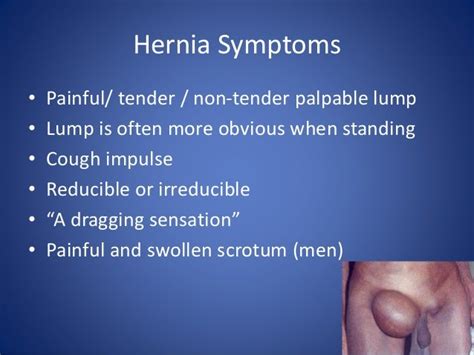 Femoral Hernia Symptoms Men Hernias Dr John Uecker February 02