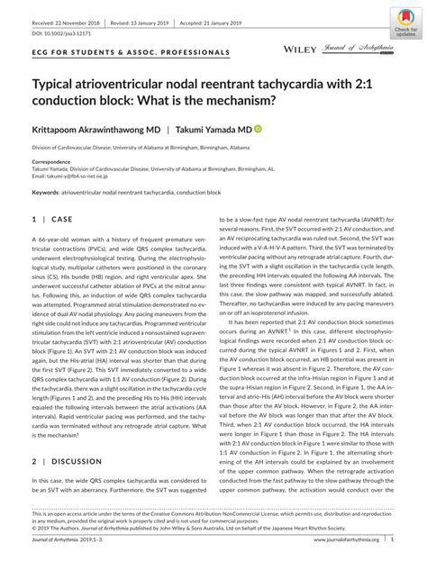 PDF Typical Atrioventricular Nodal Reentrant Tachycardia With