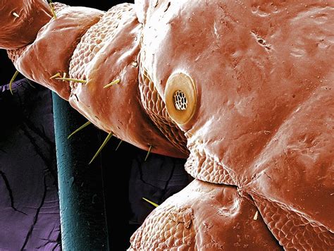 Head Louse Spiracle Photograph By Karsten Schneiderscience Photo
