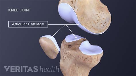 What Is Cartilage