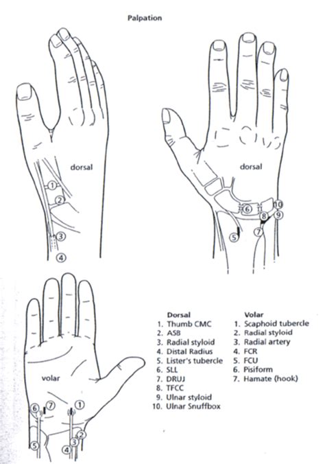 Wrist Examination Epomedicine