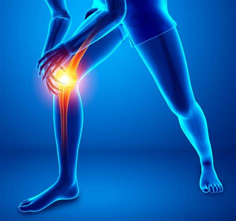 Acl Surgery Nyc Acl Treatment New York