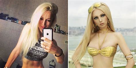 These People Who Had Extreme Plastic Surgery Will Shock You