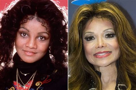Celebs Who Are Unrecognizable After Having Plastic Surgery Misterstocks