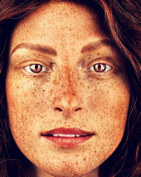 The Beauty Of The Freckles By The Photographer Brock Elbank Beautiful Freckles Freckles