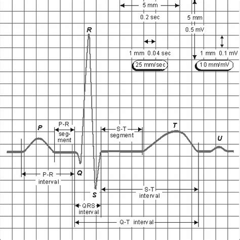 Details Of The Smoothing Ecg First Second And Third Period Of The Ecg