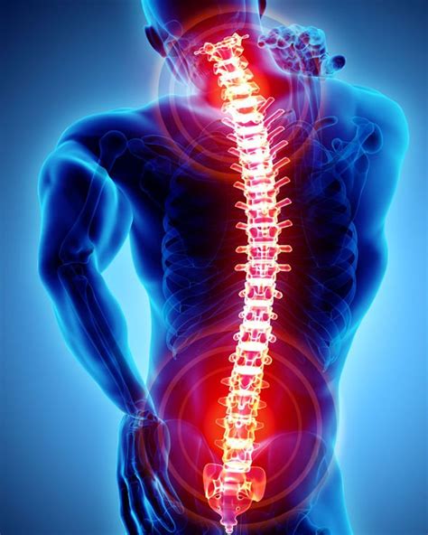 Back Pain The Serious Signs And Symptoms To Watch Out For Uk