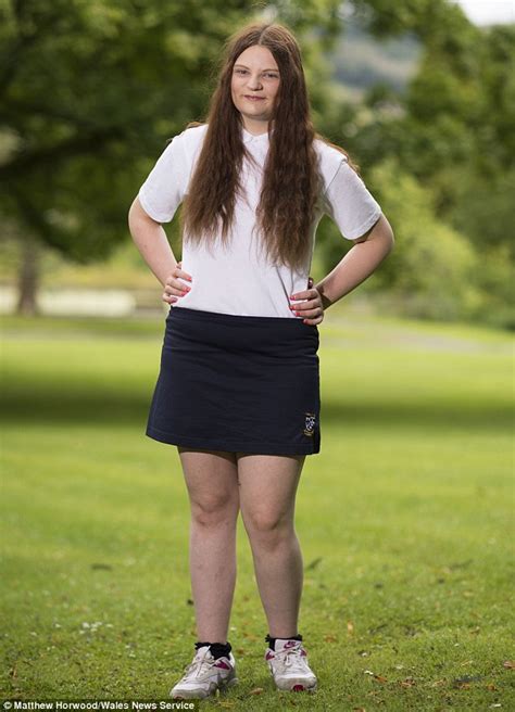 Morbidly Obese Teen Loses Five Stone After Being Told That Shes Too