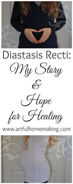 Diastasis Recti My Story And Hope For Healing Diastasis Recti