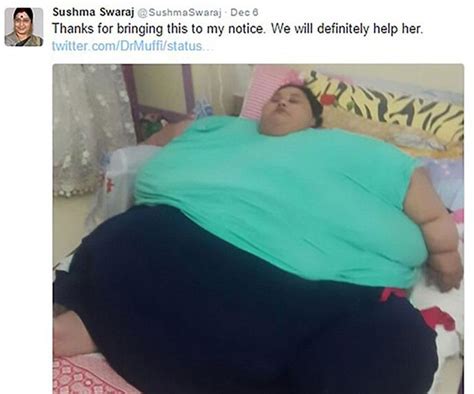 Woman Dubbed ‘world S Fattest Woman To Get Operation Australian Women S Weekly