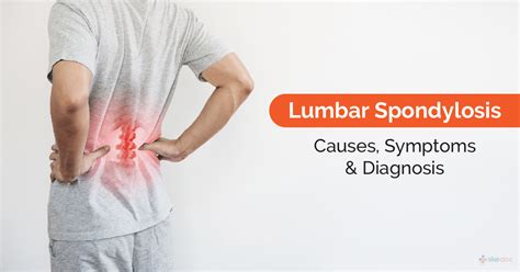 Lumbar Spondylosis Causes Symptoms Diagnosis And Treatment