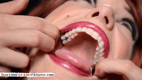 Raven Rae S Dental Problems 720p Anatomik Media Custom Fetish