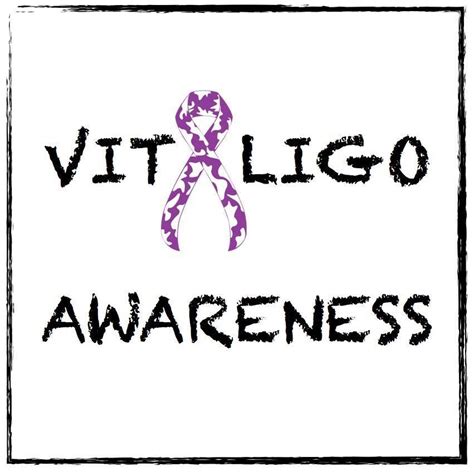 Vitiligo Awareness Vitiligo Awareness Vitiligo Photos