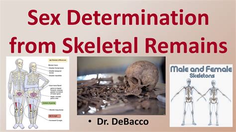 Sex Determination From Skeletal Remains Youtube