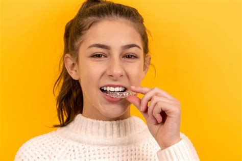 7 Tips On Cleaning Invisalign Aligners