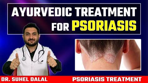 Ayurvedic Treatment For Psoriasis Psoriasis Treatment In Ayurveda