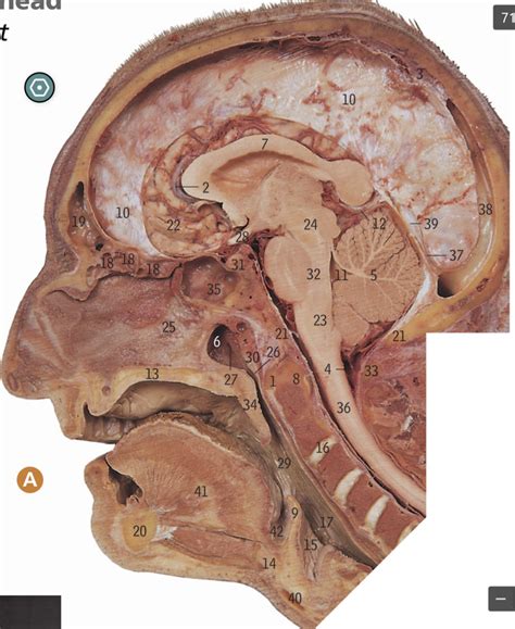 Sagittal Section Of The Head Right Half From The Head Priority