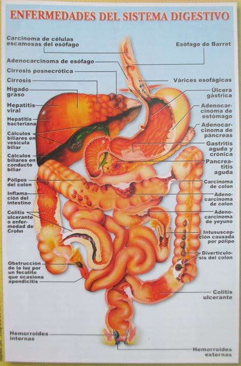 Enfermedades Del Sistema Digestivo X Sistema Digestivo Sistema My Xxx