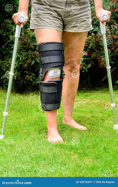 Woman With Knee In Brace After Injury Stock Photo Image 42676291