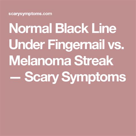 You probably already know that nail melanoma is often a dark line or stripe under the nail, but it can also be pink or a pinkish flesh color. Pin on Beauty tips