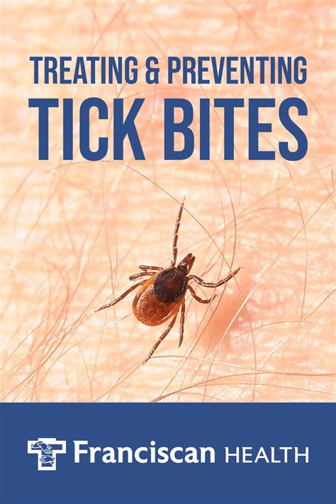 Treating And Preventing Tick Bites Franciscan Health