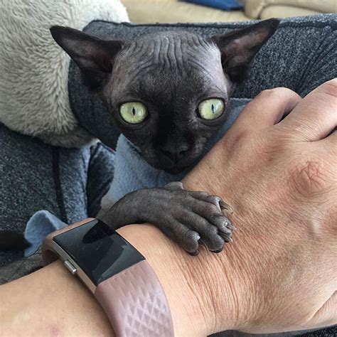 Sphynx Kitty With Rare Neurological Condition Looks Like A Bat And It