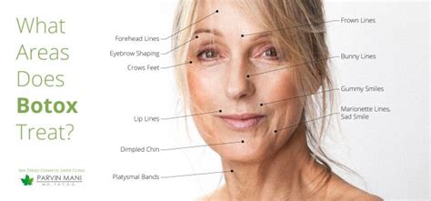 Botox Injections In San Diego San Diego Cosmetic Laser Clinic