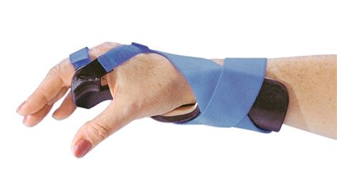 Alimed Long Ulnar Deviation Wrist Splint