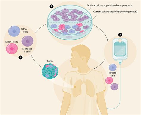 Infographic How Immunotherapy Could Boost Stem Like T Cells The