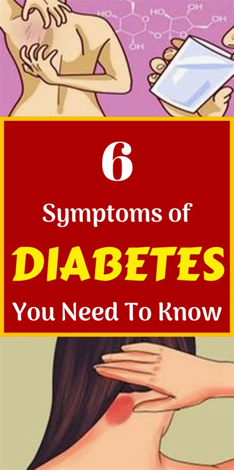 6 Symptoms Of Diabetes You Need To Know