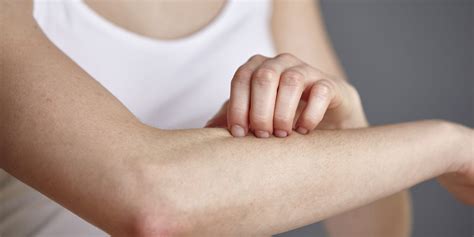 Rash On Arm Causes Itchy Red Treatments And Remedies American Celiac